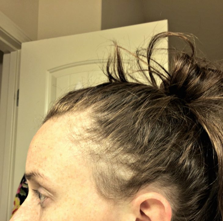 The Truth About Postpartum Hair Loss Confessions Of A Northern Belle